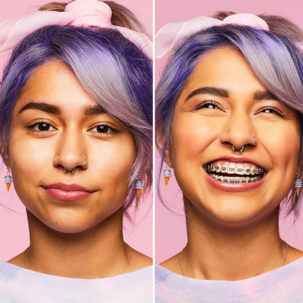 Benefit Boi-ing Hydrating Concealer 3.5g (Various Shades) 5 Benefit Boi-ing Hydrating Concealer 3.5g (Various Shades) - Image 3