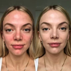 Dr. Jart+ Cicapair Tiger Grass Color Correcting Treatment 50ml 9 Dr. Jart+ Cicapair Tiger Grass Color Correcting Treatment 50ml -Fashion Cosmetics Store 12099667 1045000330247774