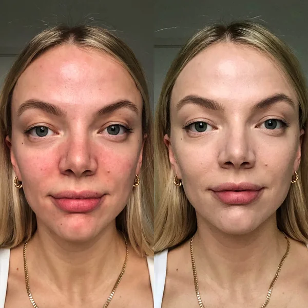 Dr. Jart+ Cicapair Tiger Grass Color Correcting Treatment 50ml 6 Dr. Jart+ Cicapair Tiger Grass Color Correcting Treatment 50ml - Image 4