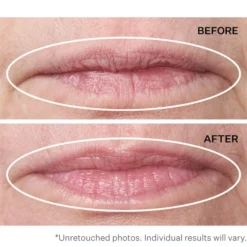 StriVectin Double Fix Plumping And Vertical Line Treatment For Lips 10ml -Fashion Cosmetics Store 12212095 1294886104806870
