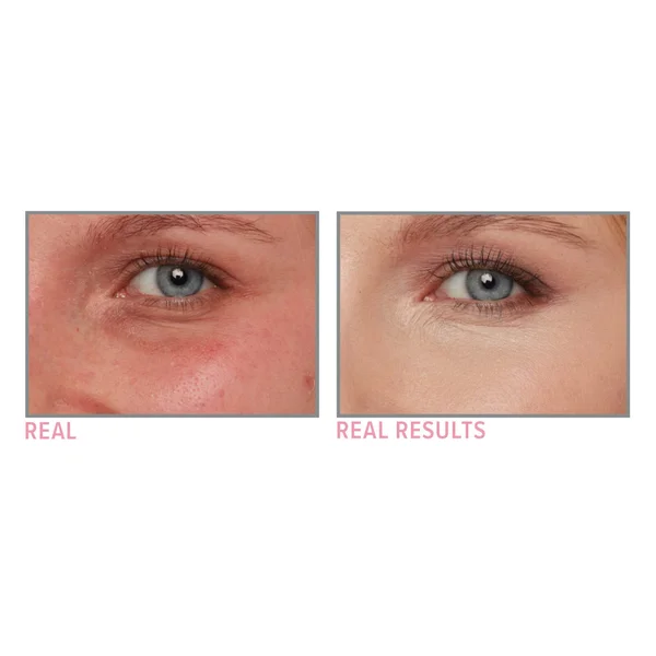 IT Cosmetics Bye Bye Under Eye Illumination 12ml (Various Shades) 5 IT Cosmetics Bye Bye Under Eye Illumination 12ml (Various Shades) - Image 3