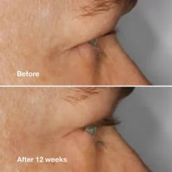 Clinique High Impact Lash Amplifying Serum 10g 9 Clinique High Impact Lash Amplifying Serum 10g -Fashion Cosmetics Store 13469775 1714935361823538